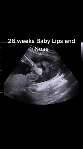Baby Lips and Nose 26 Weeks Ultrasound