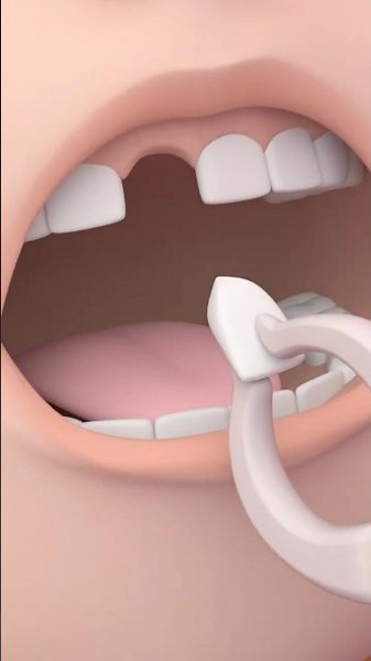 Ouch! My Front Tooth Is Loose! #IndonesianLanguage #shorts #forkids