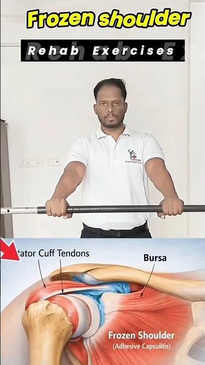 5 Simple Exercises for Frozen Shoulder | physiotherapy treatment