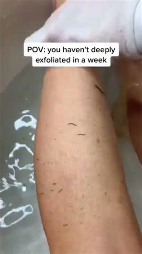 POV: you deeply exfoliated for the first time.\n\nThe confusion. The horror. The immediate need to cal