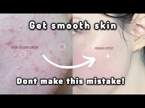 How i get rid of tiny bumbs and texture on skin - real results