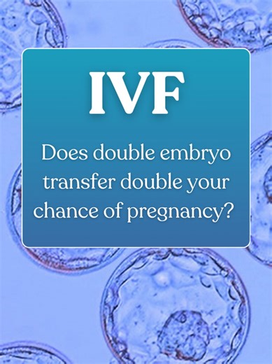 Double, and even triple (or more!) embryo transfers were more common in the early days of IVF but now single embryo transfer is by far the most common approach. This is mainly because IVF has advanced significantly so the embryos are better quality, meaning that each embryo has a higher chance of making a baby. Also, many years ago extra embryos that weren’t transferred were at risk of being lost, but now they can be successfully frozen with survival rates close to 100%. The truth is that most w