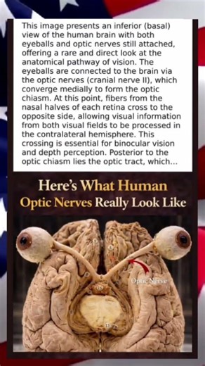 Where Sight Begins - The Human Brain with Eyes Attached