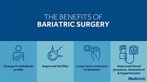 48 reactions · 15 shares | For many people, bariatric surgery is an...