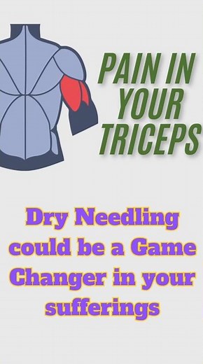 Effective Triceps Muscle Dry Needling Techniques | Pain Relief & Muscle Recovery