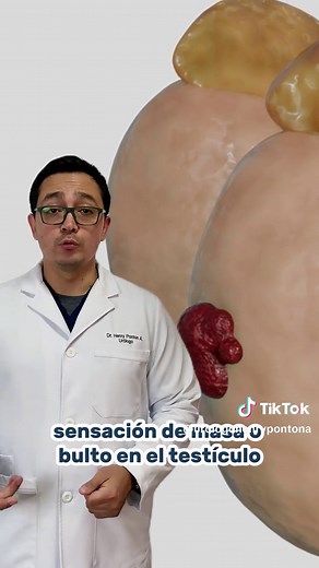 ¿Qué es un espermatocele y sus síntomas?
