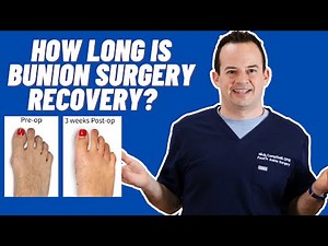 HOW LONG DOES BUNION SURGERY RECOVERY TAKE?
