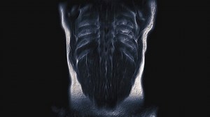 Voluminous Color Ct Scan Abdomen Computed: vídeo stock (100% livre de direitos) 1089672465 | Shutterstock