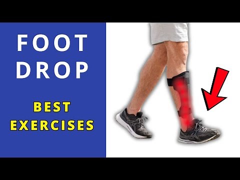 How To fix foot drop at home
