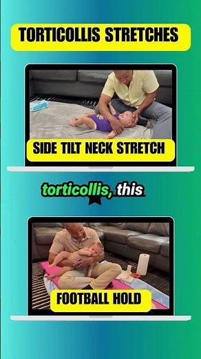 Torticollis Won't Improve? | The 2 Stretches Every Parent Needs to Know
