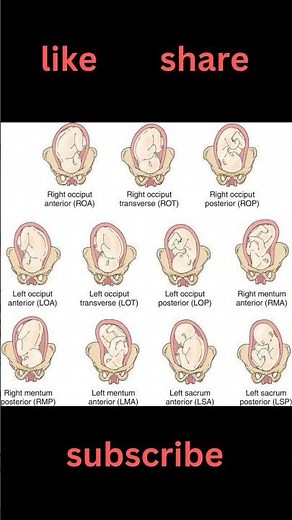 Types of fetal position||postion of fetus in uterus #short