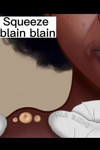 Feeling like you’re getting pimples everywhere 😩😂#fyp #clean #tiktok #stopmotionanimation #foryou #cleaning #cartoon #pimple #animation