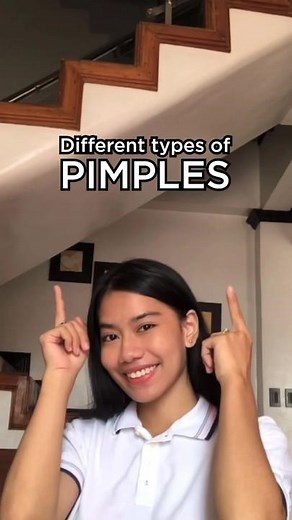 Understanding Different Types of Pimples | Acne 101