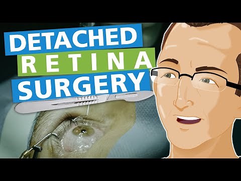 Detached Retina