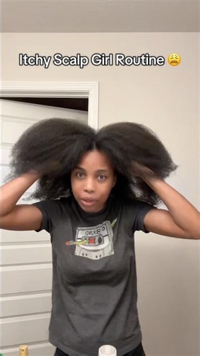 How I Soothe My Itchy Scalp & Promote Growth using These 3 Oils (4C Hair)