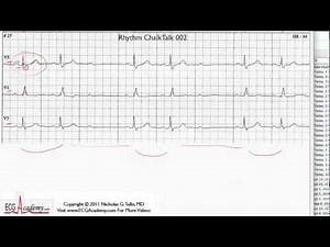 ECG Interpretation, Basic Level - Part 2 • Video • MEDtube.net