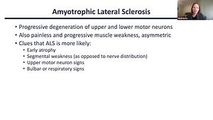Multifocal Motor Neuropathy and Its Mimics