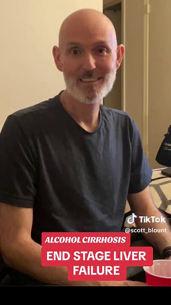 Understanding Alcohol Cirrhosis and Liver Disease