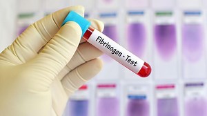 Fibrinogène : analyse et interprétation des résultats