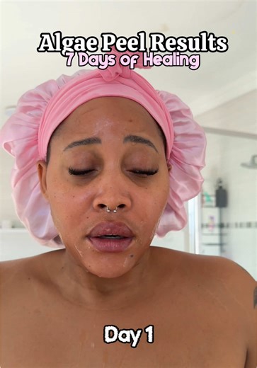 7-Day Algae Peel Process Revealed