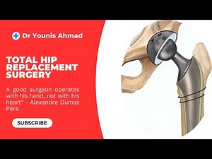 Total Hip Replacement Surgery: Procedure, Risks & Recovery Explained!