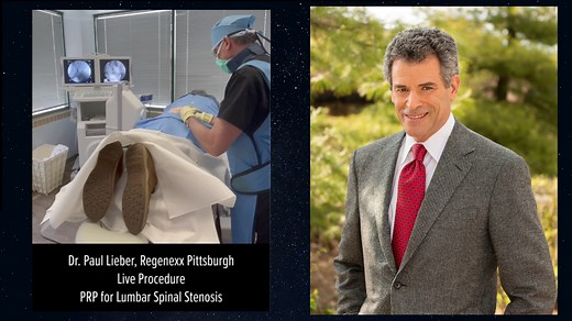PRP for Lumbar Spinal Stenosis | Regenexx® Pittsburgh Surgery Alternative