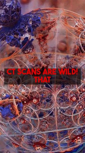 CT Scan Technology Revealed Equipment Behind The Images