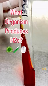 TSI agar media: ☄️The biochemical test that measures the presence of metabolic pathway of the bacteria. ☄️TSI agar contains glucose, sucrose, lactose, ferric citrate and phenol red indicator in basal medium. ☄️The concentration of lactose and sucrose in the medium is ten times that of glucose. ☄️Ferric salt is added for testing H2s production ☄️The medium is inoculated with bacterial culture using a straight wire, first stabbing the butt and then streaking the slope in a zigzag pattern. The inoc