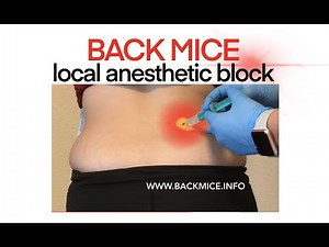 Simple back mouse treated with local subcutaneous anesthetic injection