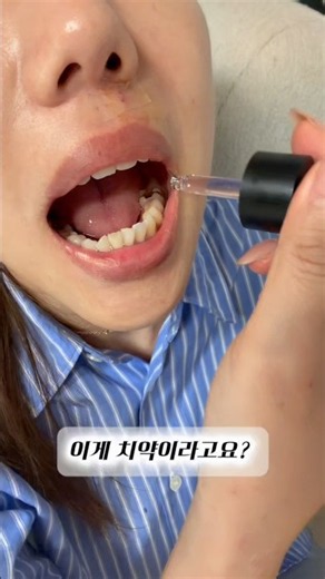 치과·약국 품절 대란 일으킨 '파로덱스 잇몸 앰플 치약' 직접 써봤습니다 🦷✨#파로덱스잇몸앰플치약 #파로덱스 #잇몸앰플치약 #액상치약
