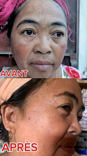 1.3K views · 12 reactions | PACK PLUS DE 37 ANS BIO Anti_rideAnti_âge Anti_veilleuse Anti_acné ✅Crème liposome ✅Savon escargot ✅Écran solaire Prix 1.750.000 fmg Produit bio made in Italie sans effet secondaire ❤️DISPO BOUTIQUE TANA itaosy dalle Livraison partout Mp na miantso 0329581995 na 0325642331 | Faouzia Bellemetisse Hair'Boutik | Facebook