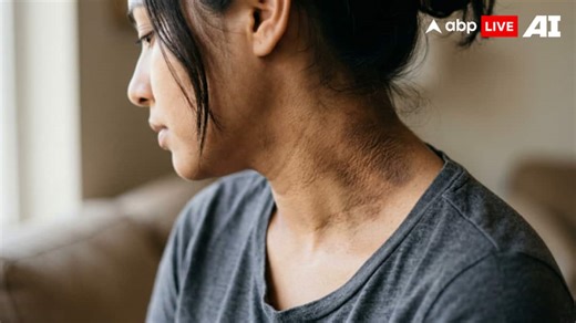 Dark Neck Warning Signs: 4 Things Black Patches On Your Neck Reveal About Your Health
