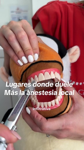 ¿Por qué duele la anestesia dental en la boca?
