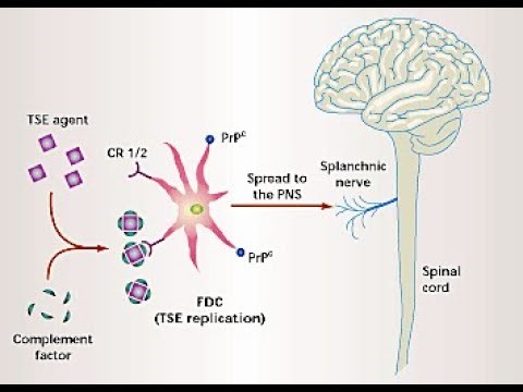 Transmissible spongiform Encephalopathies -Prion disease