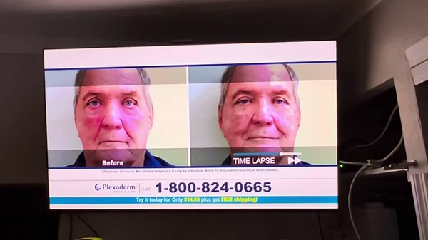 Plexaderm Skincare Commercial