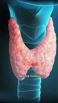 Thyroidectomy Surgery Explained – How Surgeons Remove the Thyroid