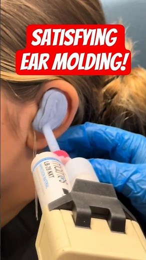 Ear Impression Using Injection Gun | Custom Ear Mold