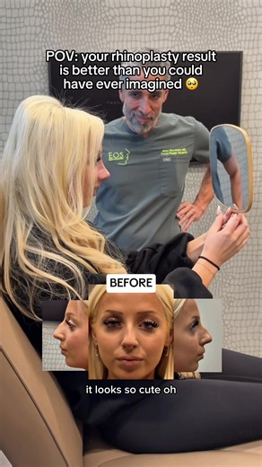 Cast Removal Appointment for New Nose: One Week Post-Op