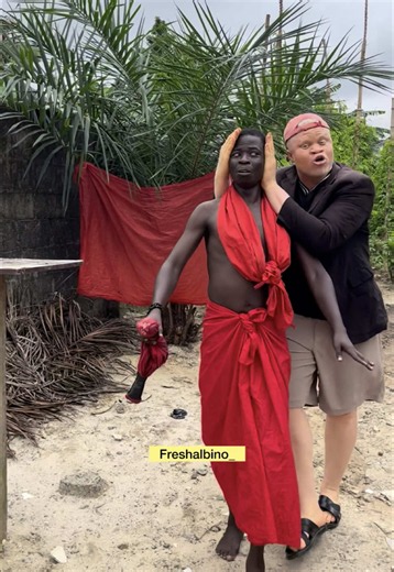Be straightforward please 😂#fyp #freshalbino_ #freshalbino_1 | fresh