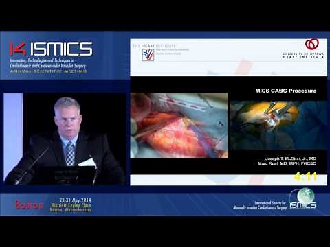 Minimally Invasive CABG is Safe and Reproducible Report on the First Thousand Cases