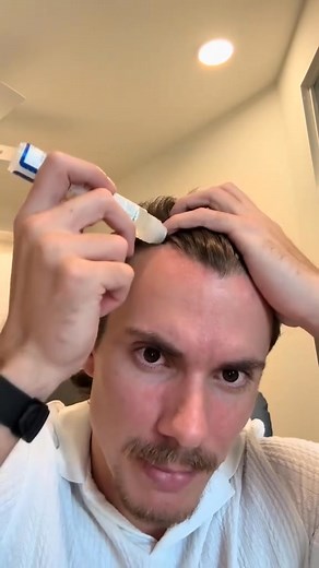 Tired of Losing Hair? You're Not Alone. 六‍零 Meet the breakthrough in...