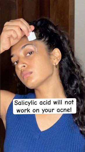 The real way to get rid of acne