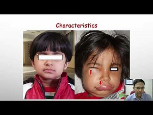 Hereditary Angioedema • Video • MEDtube.net