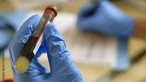 extreme closeup of test tube of blood taken for a blood test