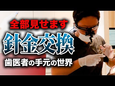 ワイヤー矯正7ヶ月目！針金交換の治療シーンを全部見せます！【審美歯科 歯列矯正 歯並び 治療シーン】