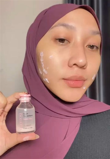 Totol Jerawat Dojako for Acne Prone Skin