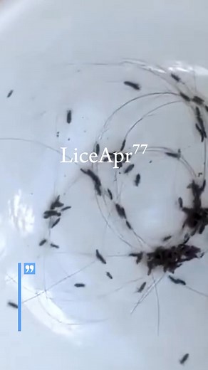 Lice nest in the head and hair which is often damp, so we must always take care of the health of our hair and scalp🙄 #Lice #piojos #kutu #hairservice #property #friday #holidayevent #homebusniess #denver #fridaymotivation #newrelease #fridayvibes #hoidayoutfit #discountedclothing #RHA #KMD | Joss A Walker