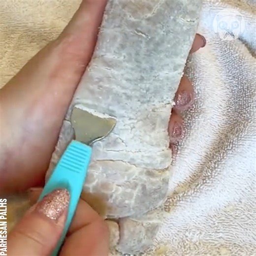 Shaving callouses off this foot due to a rare skin condition Partner: Parmesan Palms | Bored Panda Art