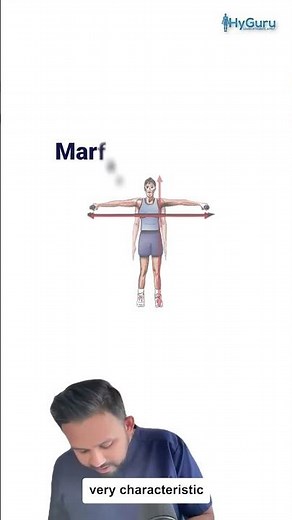 Marfan Syndrome for the USMLE | HyGuru