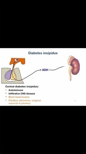Diabetic Ketoacidosis (DKA) An Animated Breakdown